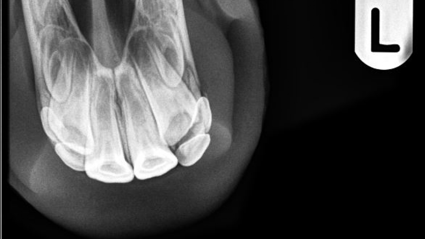 Partlan teeth xray